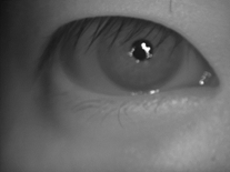 Right Iris Iris Image